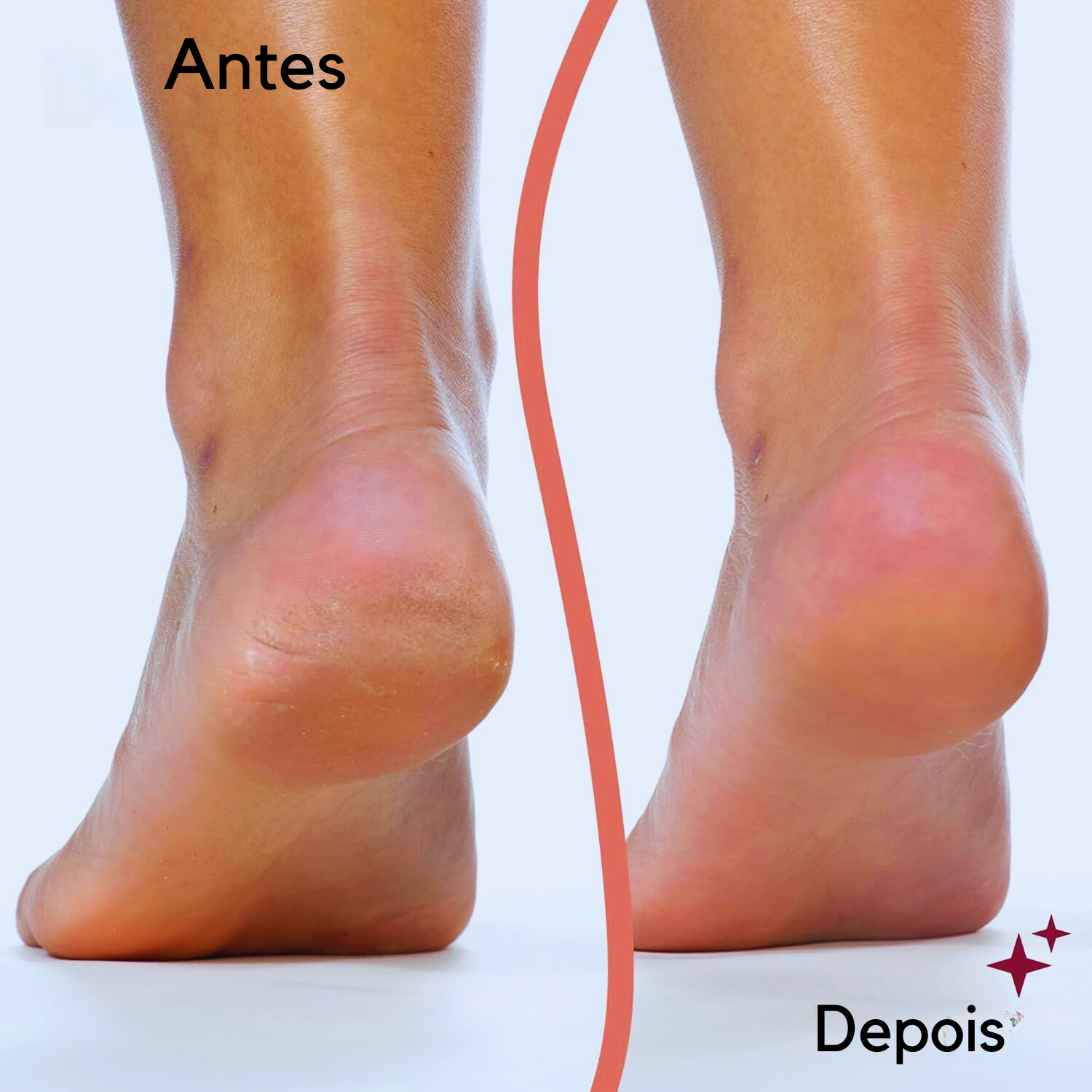 Antes