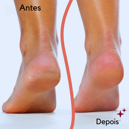 Antes