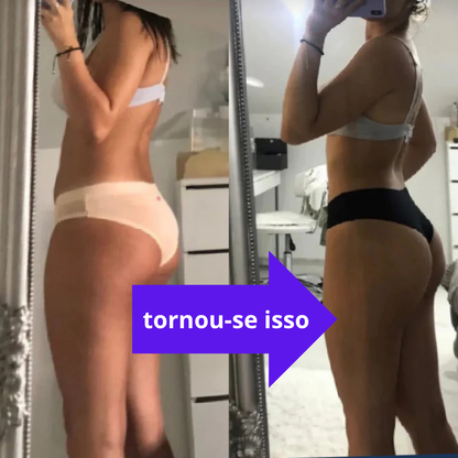 SlimTone® Pro - Dispositivo de remoção